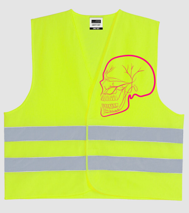  minta neonsárga pólón